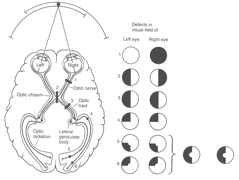 ../figures/LRprojection2.gif